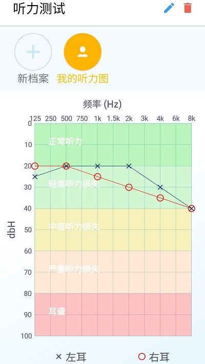 艾米助听官方版